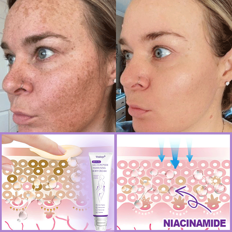 30% OFF✨✨ Vitalisys® PDRN Multi-Peptide Massaging Body Roller Cream- Anti-aging, Hydrating, Skin Firming & Lifting, Skin Repair, Even Tone, Acne and Dark Spot Treatment, Wart and Mole Removal, and Psoriasis Relief
