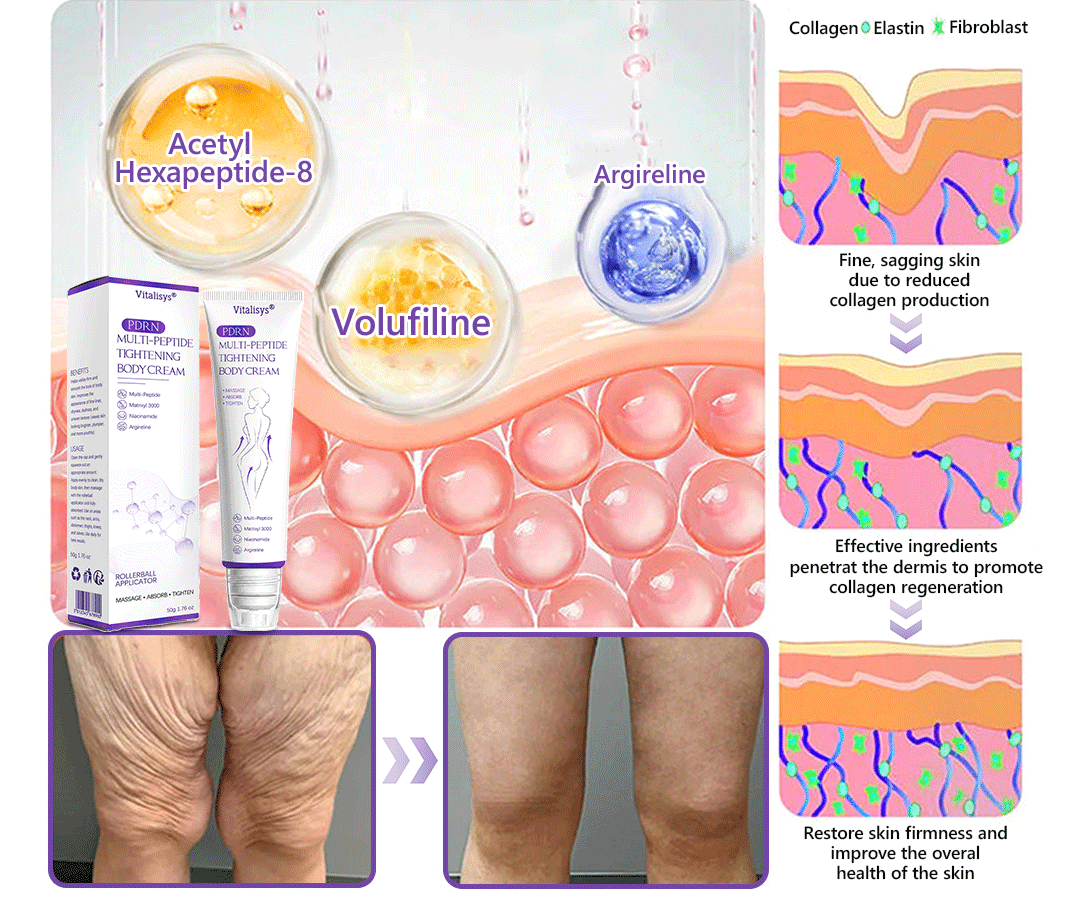 30% OFF✨✨ Vitalisys® PDRN Multi-Peptide Massaging Body Roller Cream- Anti-aging, Hydrating, Skin Firming & Lifting, Skin Repair, Even Tone, Acne and Dark Spot Treatment, Wart and Mole Removal, and Psoriasis Relief