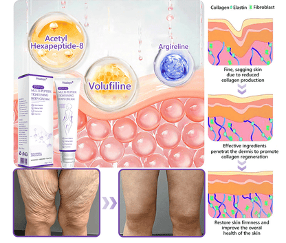 30% OFF✨✨ Vitalisys® PDRN Multi-Peptide Massaging Body Roller Cream- Anti-aging, Hydrating, Skin Firming & Lifting, Skin Repair, Even Tone, Acne and Dark Spot Treatment, Wart and Mole Removal, and Psoriasis Relief