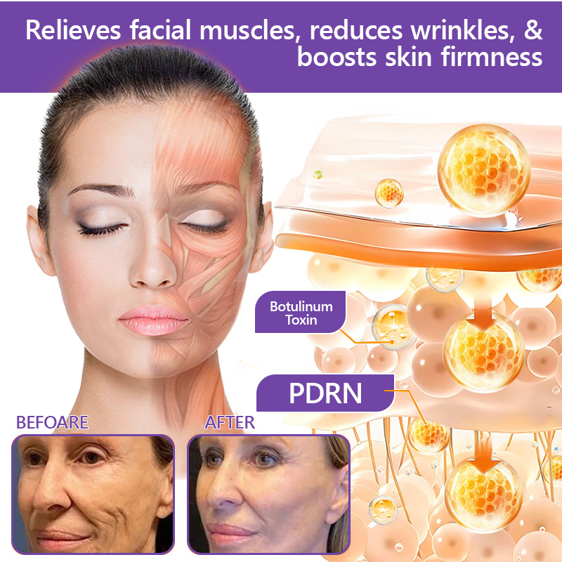 30% OFF✨✨ Vitalisys® PDRN Multi-Peptide Massaging Body Roller Cream- Anti-aging, Hydrating, Skin Firming & Lifting, Skin Repair, Even Tone, Acne and Dark Spot Treatment, Wart and Mole Removal, and Psoriasis Relief