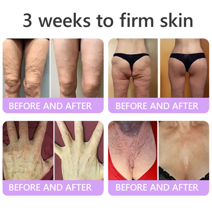 30% OFF✨✨ Vitalisys® PDRN Multi-Peptide Massaging Body Roller Cream- Anti-aging, Hydrating, Skin Firming & Lifting, Skin Repair, Even Tone, Acne and Dark Spot Treatment, Wart and Mole Removal, and Psoriasis Relief