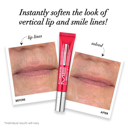 Perioral Anti-Aging Treatment - Professional Strength