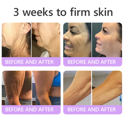 30% OFF✨✨ Vitalisys® PDRN Multi-Peptide Massaging Body Roller Cream- Anti-aging, Hydrating, Skin Firming & Lifting, Skin Repair, Even Tone, Acne and Dark Spot Treatment, Wart and Mole Removal, and Psoriasis Relief
