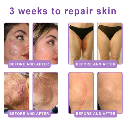 30% OFF✨✨ Vitalisys® PDRN Multi-Peptide Massaging Body Roller Cream- Anti-aging, Hydrating, Skin Firming & Lifting, Skin Repair, Even Tone, Acne and Dark Spot Treatment, Wart and Mole Removal, and Psoriasis Relief