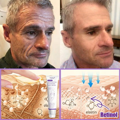 30% OFF✨✨ Vitalisys® PDRN Multi-Peptide Massaging Body Roller Cream- Anti-aging, Hydrating, Skin Firming & Lifting, Skin Repair, Even Tone, Acne and Dark Spot Treatment, Wart and Mole Removal, and Psoriasis Relief
